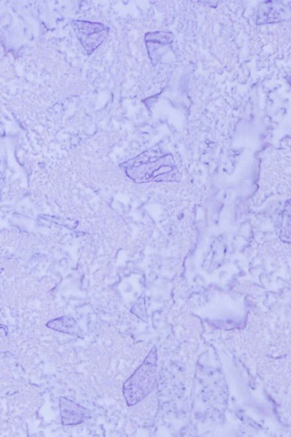 Expressions Batiks Hand-Dyed Periwinkle by Riley Blake Designs – Pinterest close-up detail of hand-dyed periwinkle blue tonal texture